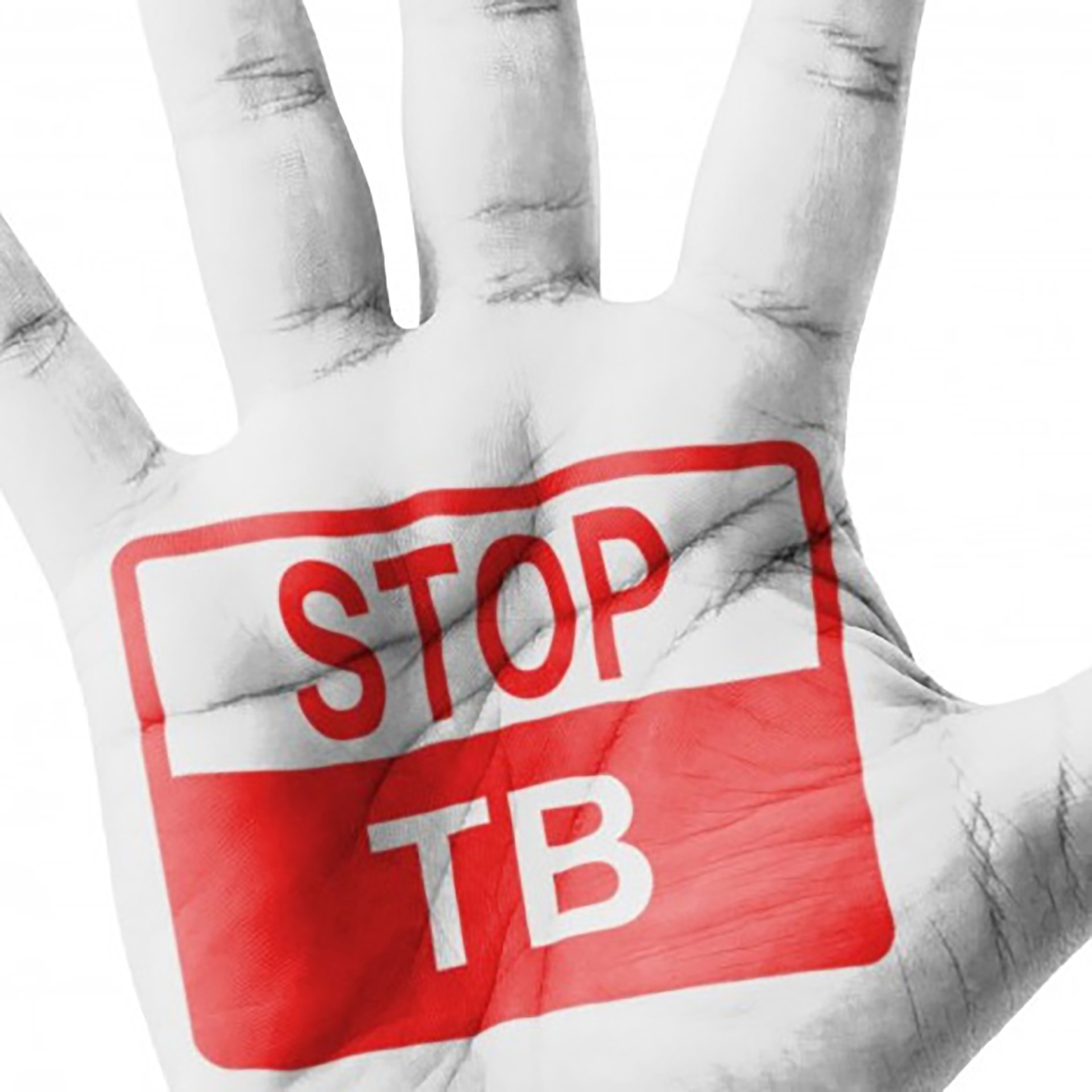 UJ commemorates World TB Day, free screenings for staff and students