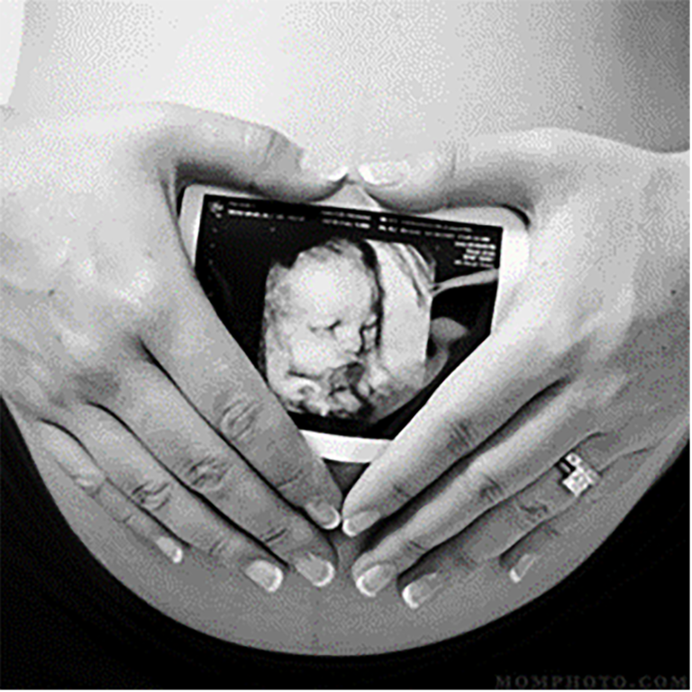 UJ Health Sciences students boost antenatal care