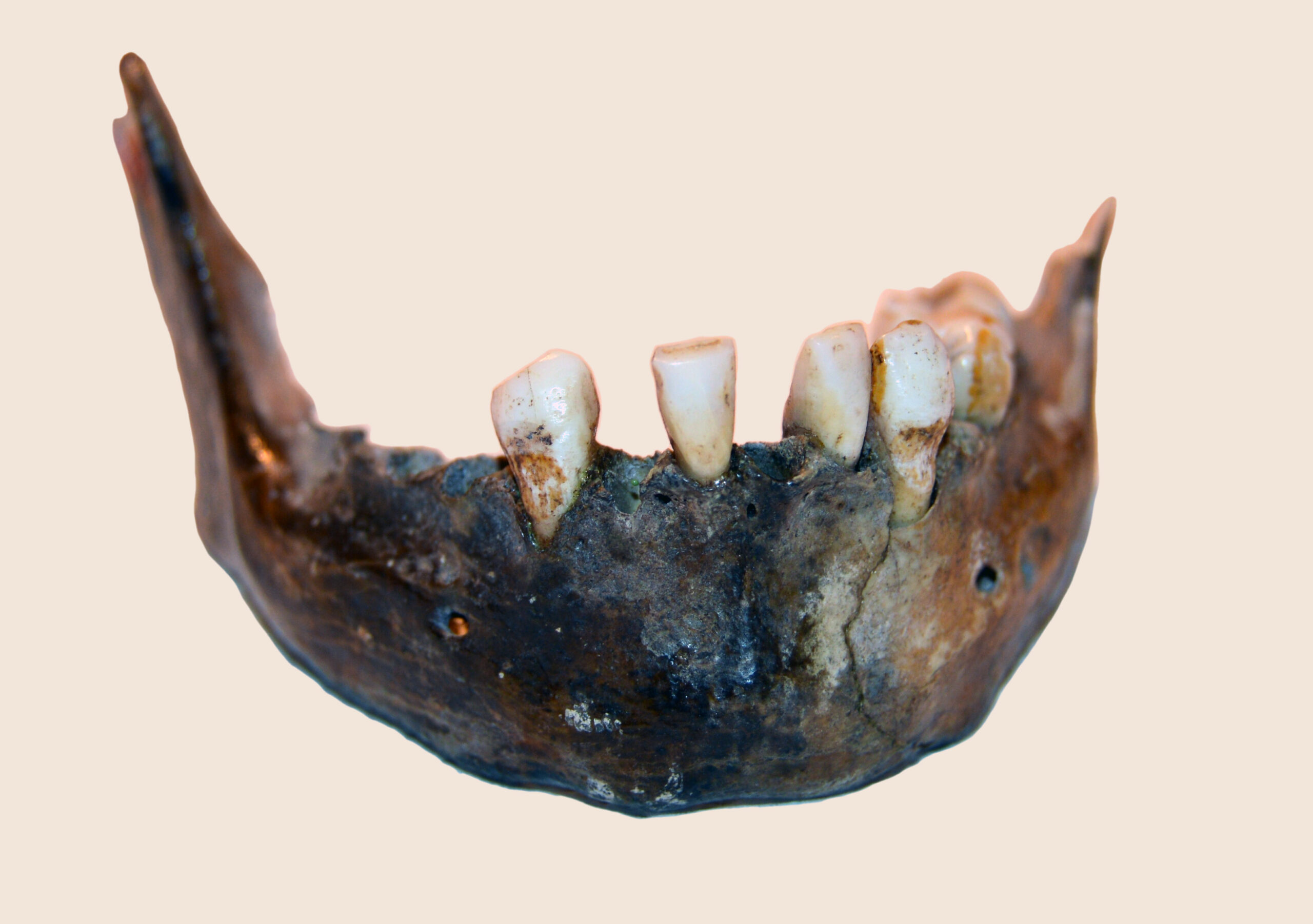Mandible of Matjes River 1 woman_2